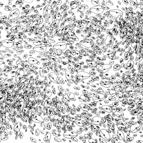 Eyes_20copy_medium